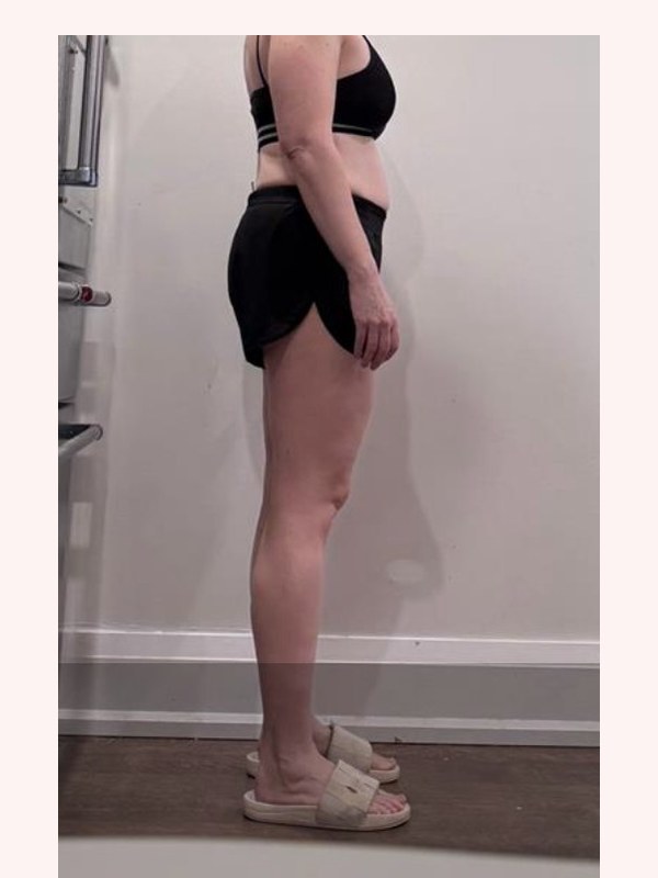 Client after two to three months