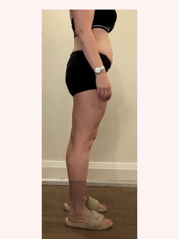 Client before coaching